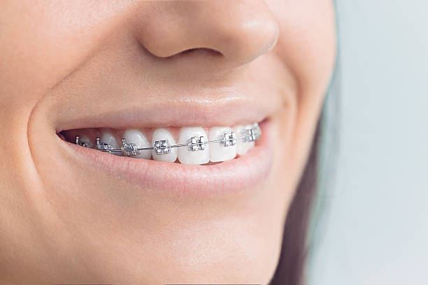 Best Dental Implants  in Williston, FL